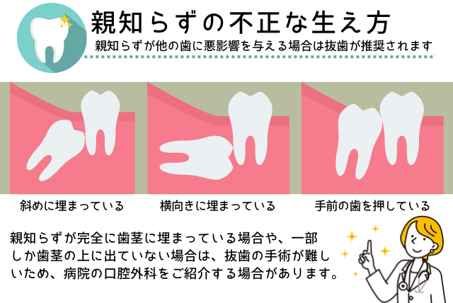 親知らずの不正な生え方