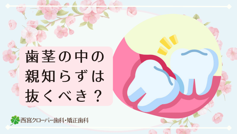 歯茎の中の親知らずは抜くべき？