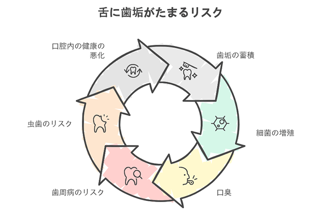 舌に歯垢がたまるリスク