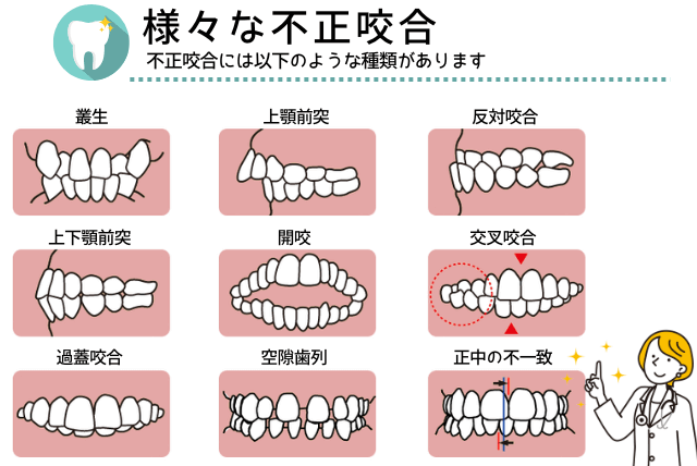 不正咬合