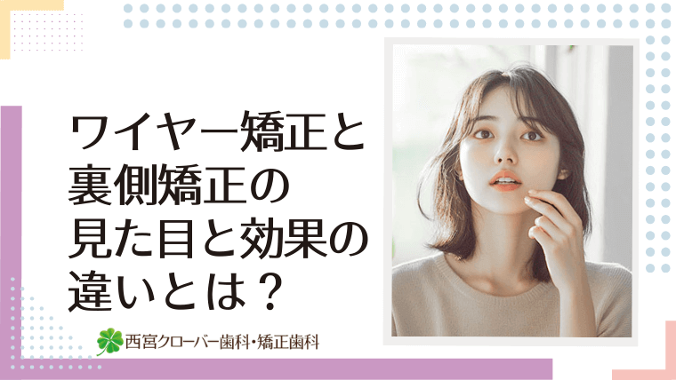 ワイヤー矯正と裏側矯正の見た目と効果の違いとは？