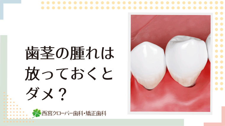 歯茎の腫れは放っておくとダメ？