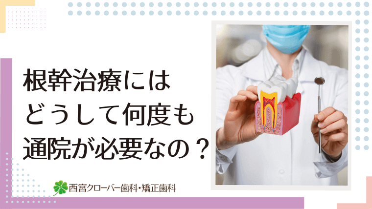 根幹治療にはどうして何度も通院が必要なの？